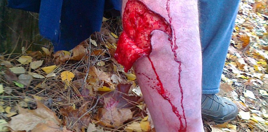 Przypadek kliniczny nr 26