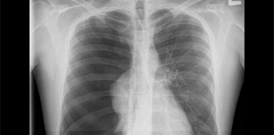 Co jest na zdjęciach?