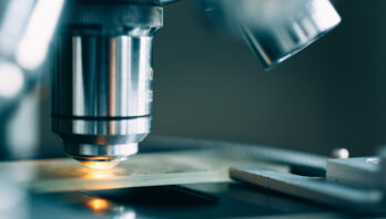 Śmierć bliskiej osoby to jedno z najbardziej granicznych doświadczeń. “Trudno wrócić do zwykłego życia”